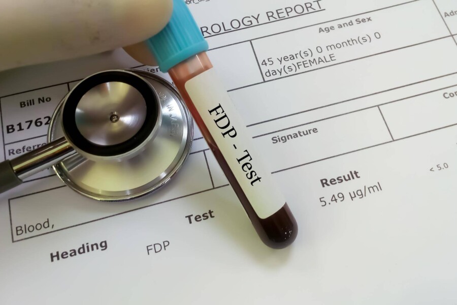 Jak długo działa ubezpieczenie zdrowotne po zakończeniu pracy?